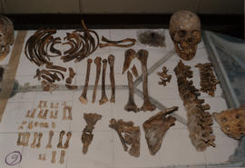 Fotografía de restos óseos de ejecutado político